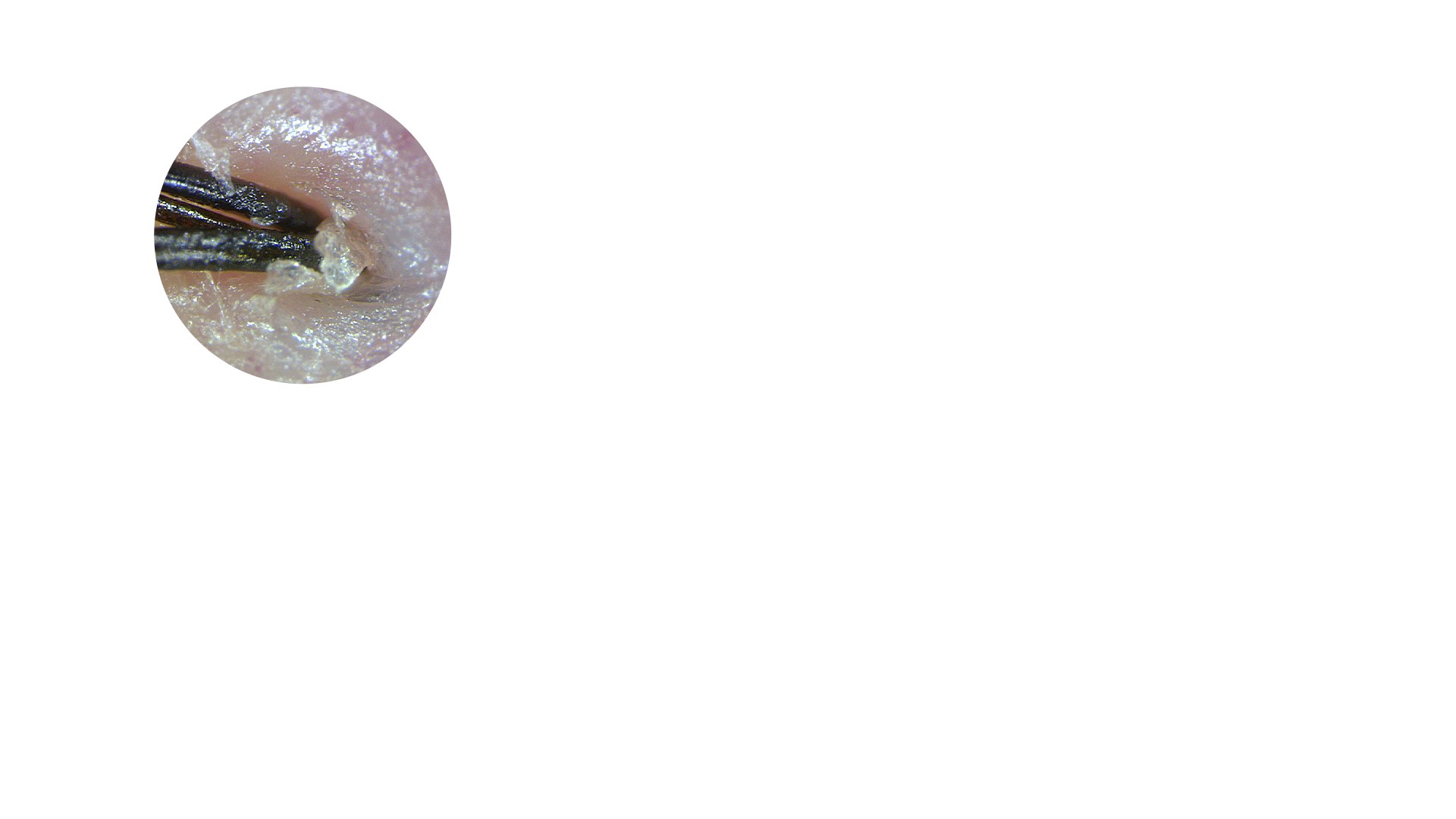 肌トラブルの原因 | 毛穴やシワに詰まった目に見えないメイク残りに